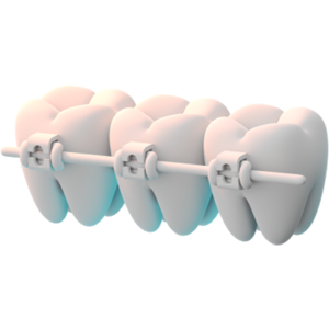 어린이치아보험 교정